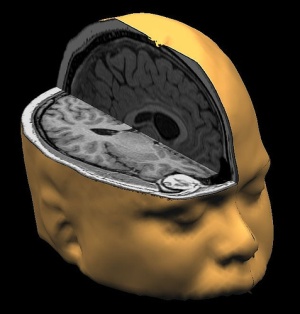 Brain 3d model Motherhood Changes Your Brain Function, New Research Says