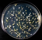 Microbes Study: Preemies Have More Dangerous Microbes Compared to Full Terms
